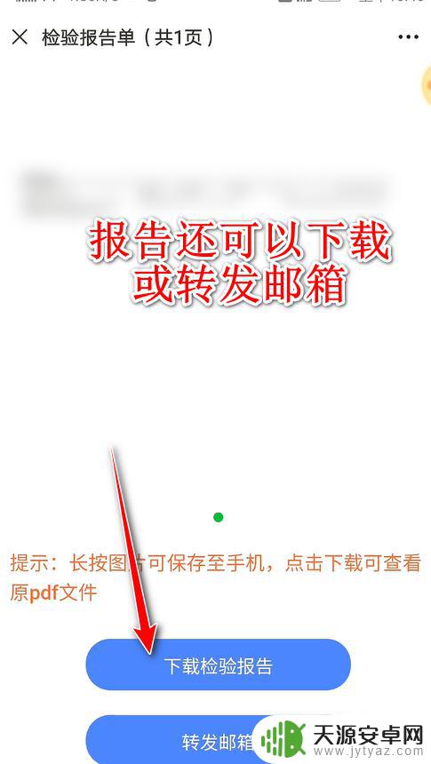 手机上查验血报告单怎么查江苏的 如何在江苏省人民医院在线查看检查报告